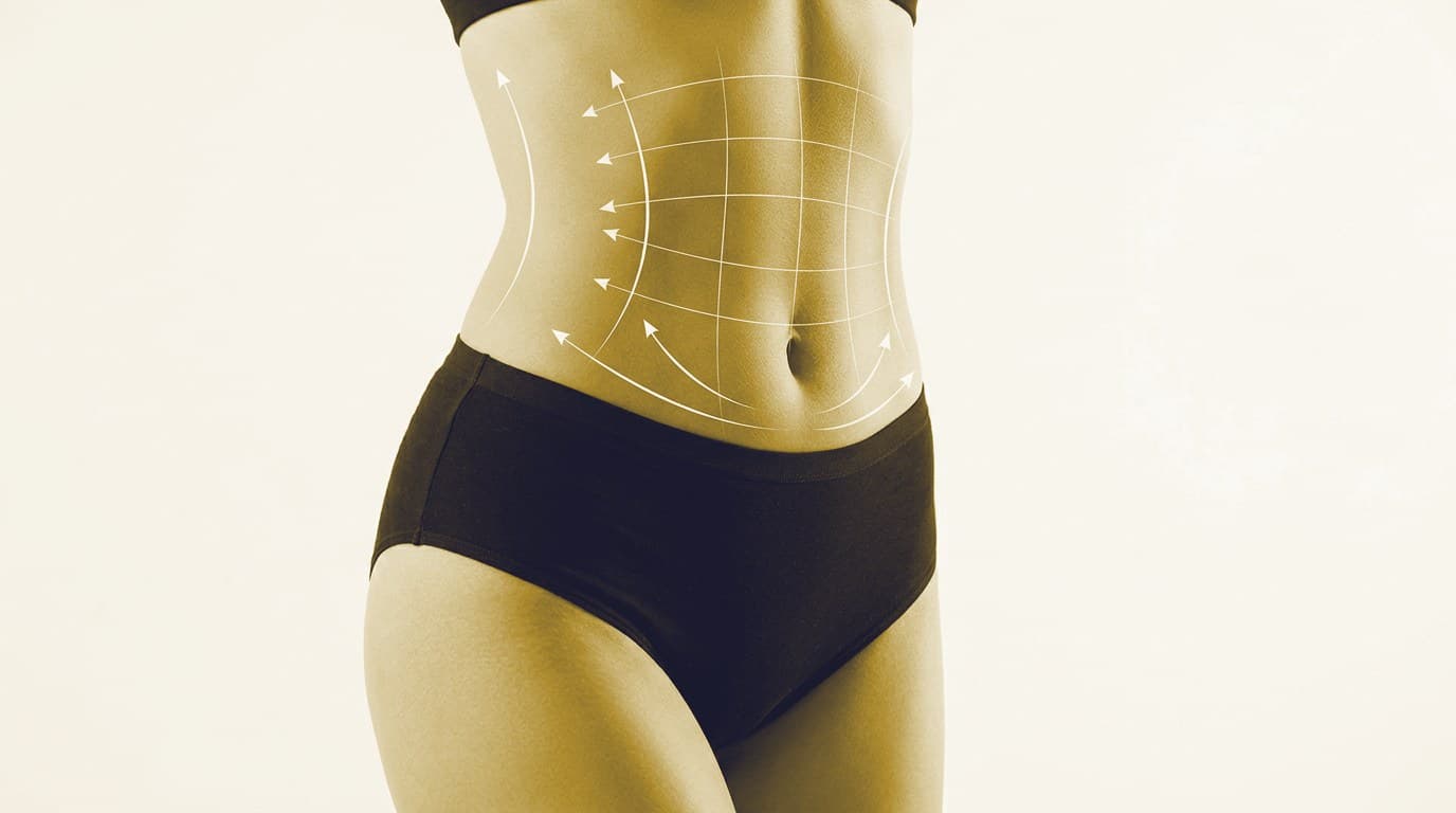 ¿Cómo saber si soy una persona apta para una Liposucción?